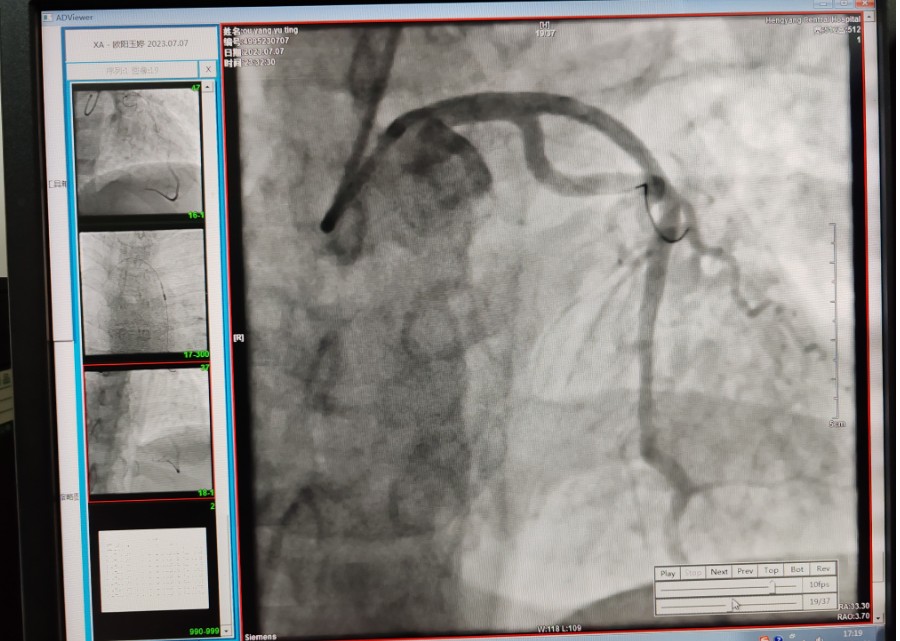 Snipaste_2023-07-24_08-20-00.jpg Snipaste_2023-07-24_08-20-00.jpg