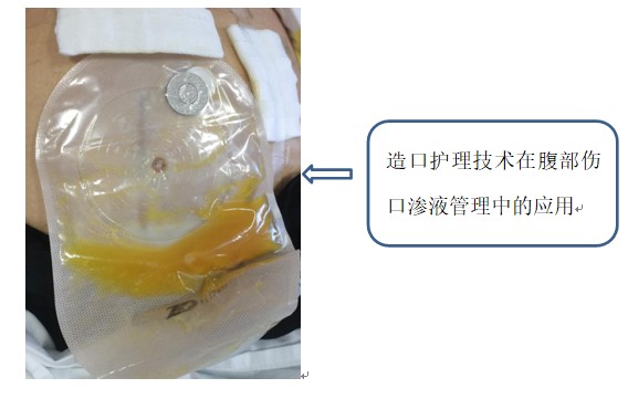 Snipaste_2023-08-01_08-17-55.jpg Snipaste_2023-08-01_08-17-55.jpg