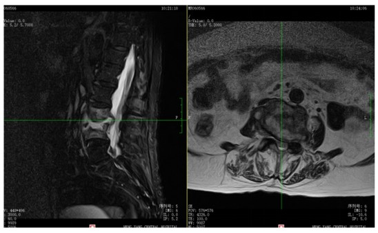 Snipaste_2024-11-07_11-46-00.jpg Snipaste_2024-11-07_11-46-00.jpg